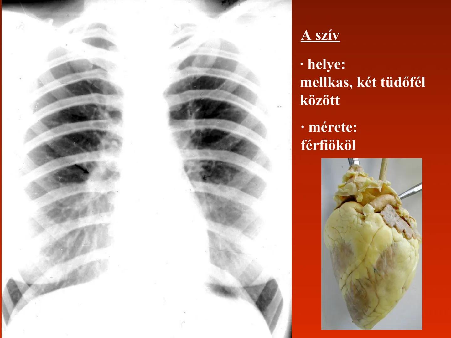 A szív (cor)
Aortic arch
(fat covered)
Pulmonary trunk
Right atrium
Left auricle of
left atrium
Anterior
interventricular
artery
Right ventr