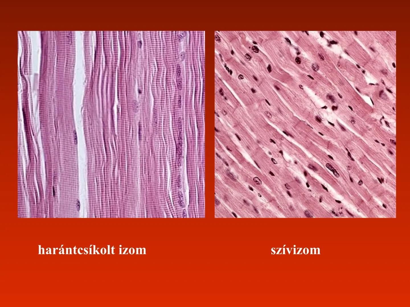 A szív (cor)
Aortic arch
(fat covered)
Pulmonary trunk
Right atrium
Left auricle of
left atrium
Anterior
interventricular
artery
Right ventr